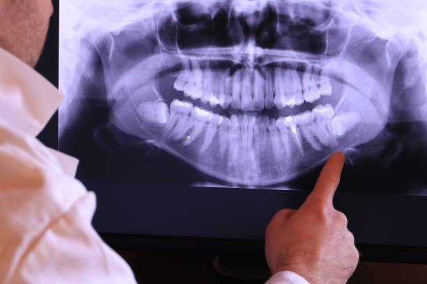 Best Emergency TMJ Treatment in Drexel, NC